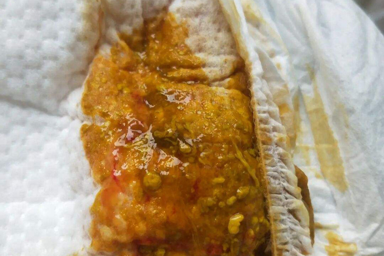 吃枇杷过敏腹泻便血图
