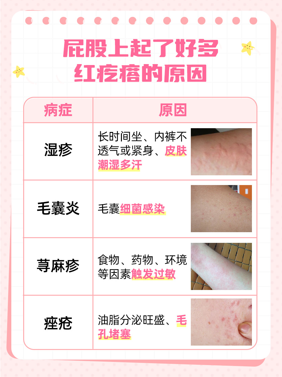专家告诉你：屁股上起了好多红疙瘩的原因
