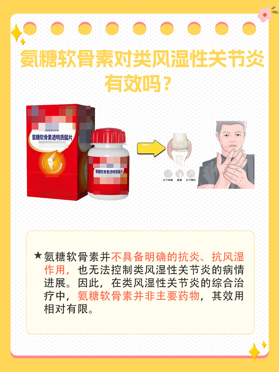 氨糖软骨素：能否成为类风湿性关节炎的有效疗法？