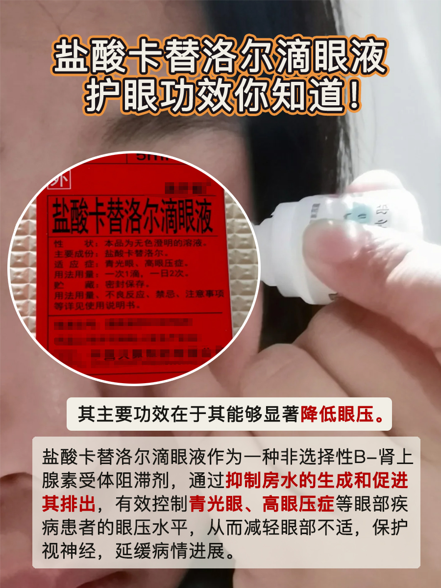 盐酸卡替洛尔滴眼液，护眼功效你知道！