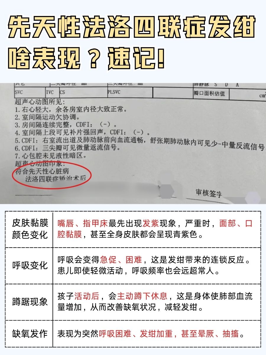 先天性法洛四联症发绀啥表现？速记！