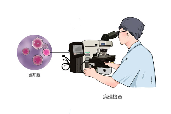 如何判断是否得了舌癌-有来医生