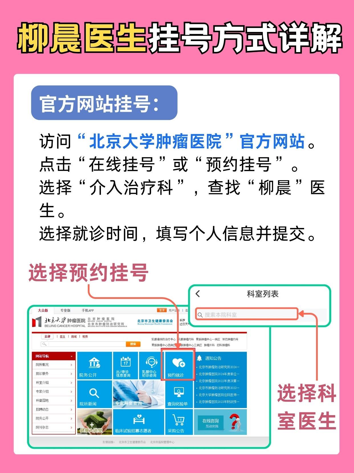 北京大学肿瘤医院柳晨医生怎么样？怎么挂号？