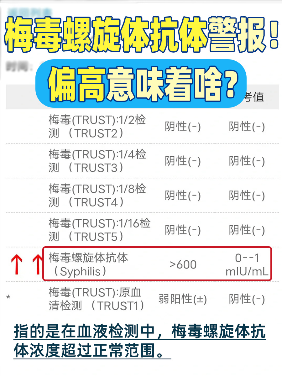 梅毒螺旋体抗体警报！偏高意味着啥？