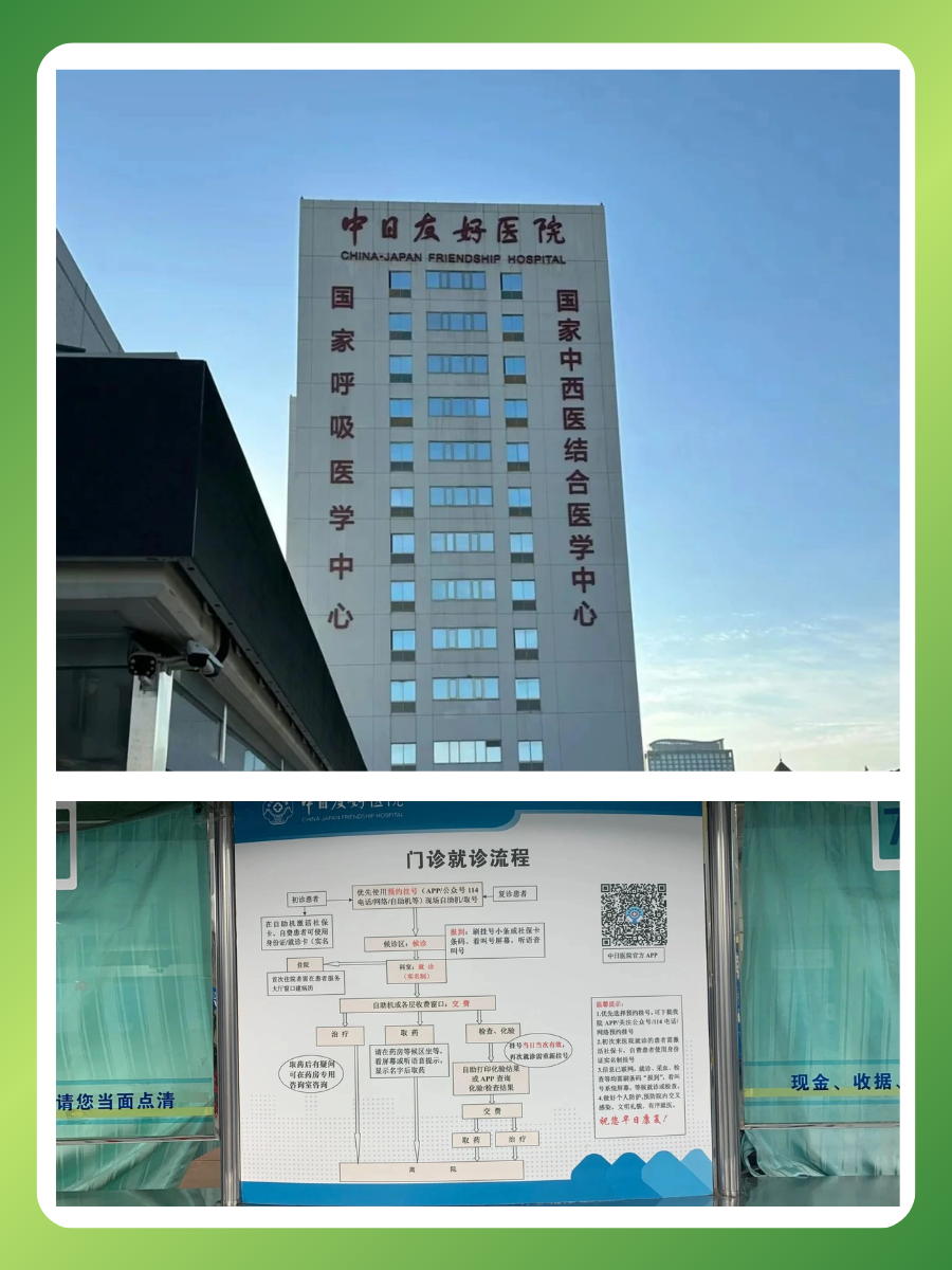 中日友好医院邵自强医生怎么样？怎么挂号？