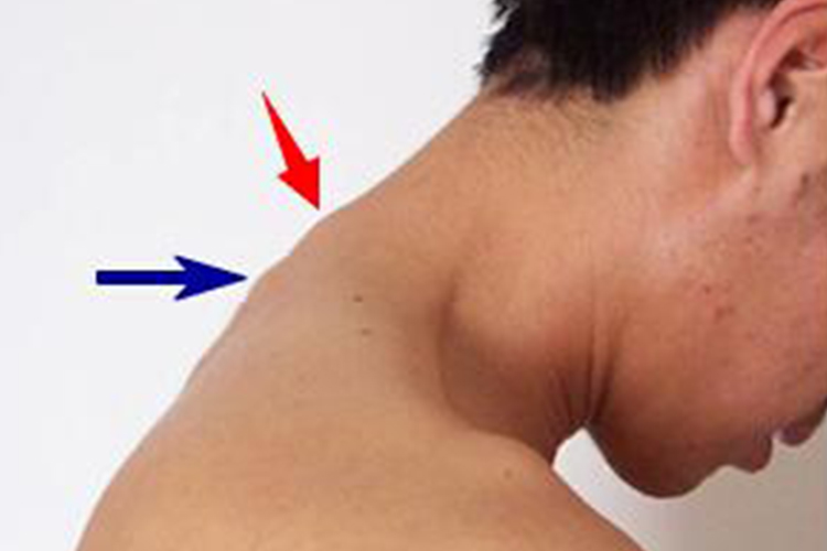 脊椎体隆突位置图