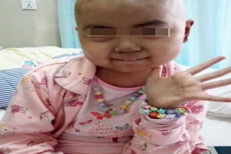 白血病儿童早期嘴唇图