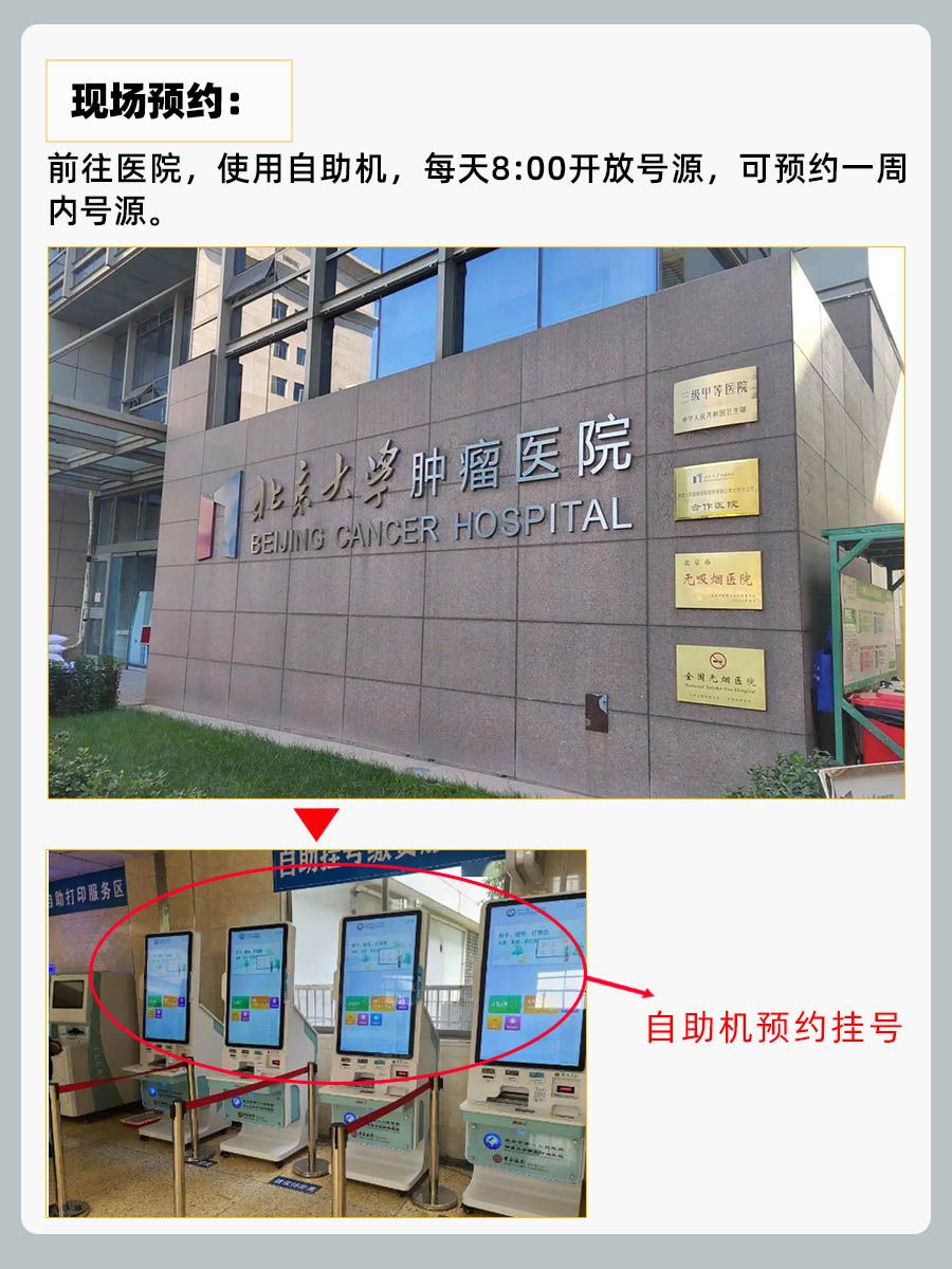 北京肿瘤医院赵军医生怎么样？怎么挂号？