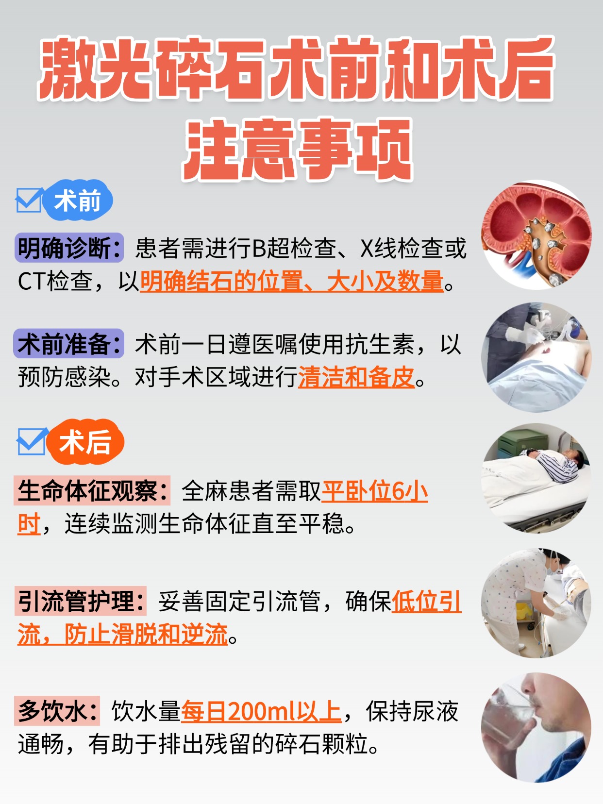 激光碎石费用大起底，速来了解！