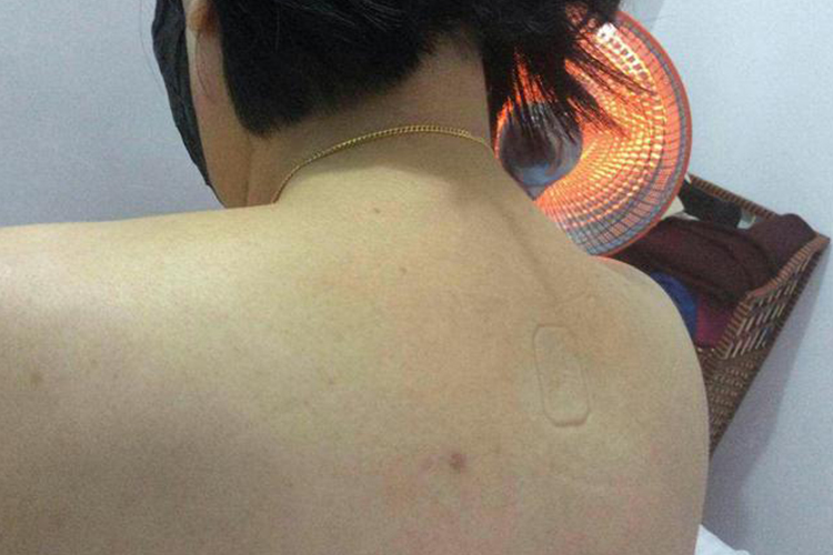 富贵包早期症状不明显图