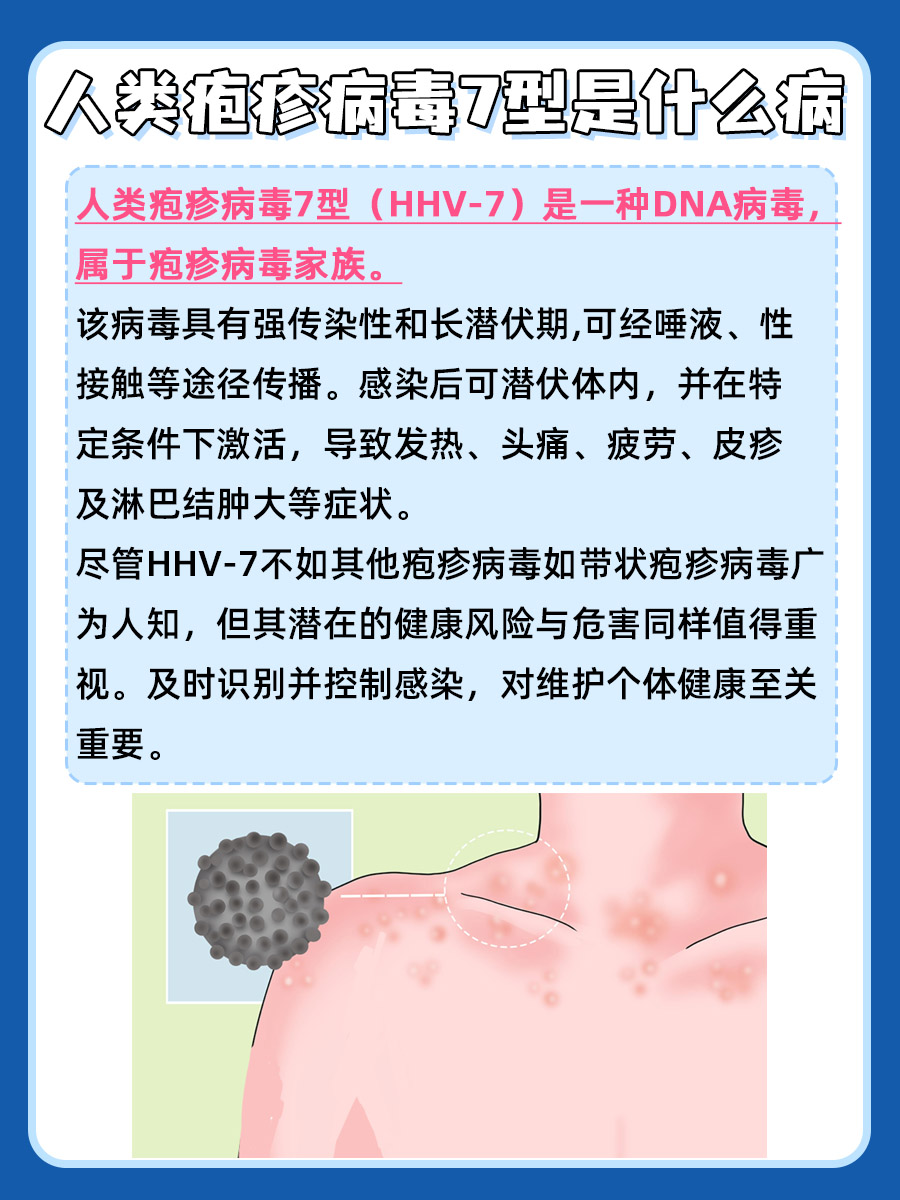 人类疱疹病毒7型是什么病？一文解析
