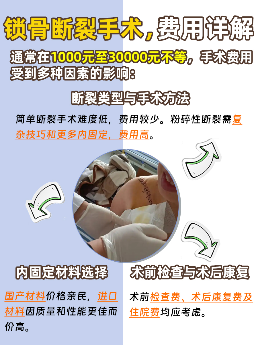锁骨断裂手术,预算早知道