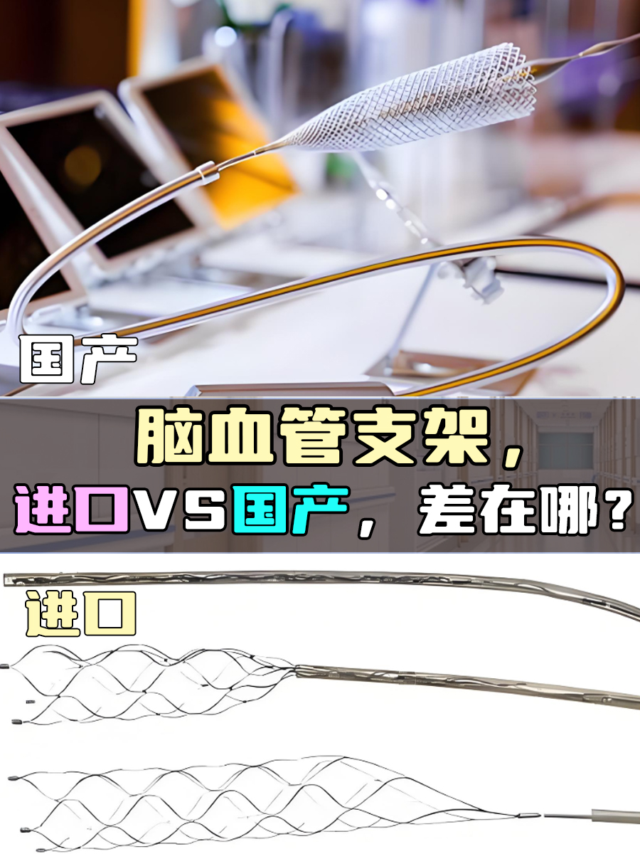 脑血管支架，进口VS国产，差在哪？