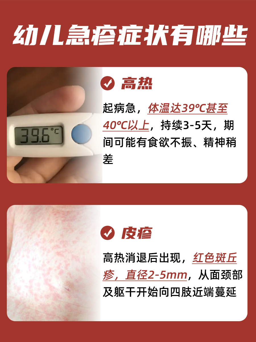 幼儿急疹症状及注意事项有哪些？一文解析