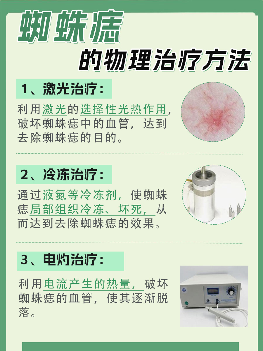 蜘蛛痣的成因,大家都知道哪些呢?