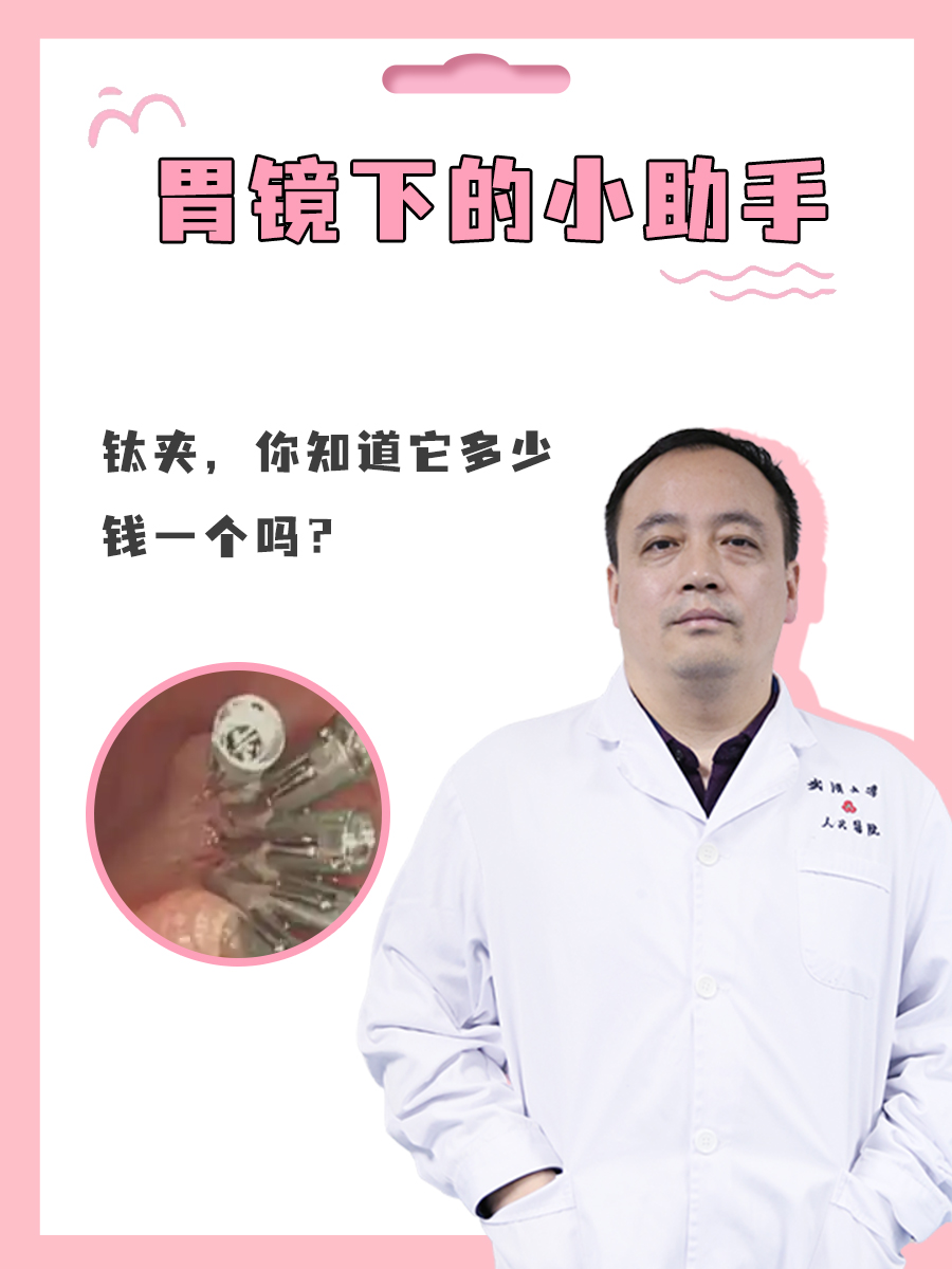 胃镜下的小助手：钛夹，你知道它多少钱一个吗？
