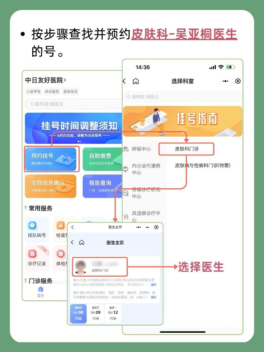 中日友好医院吴亚桐医生怎么样?怎么挂号?