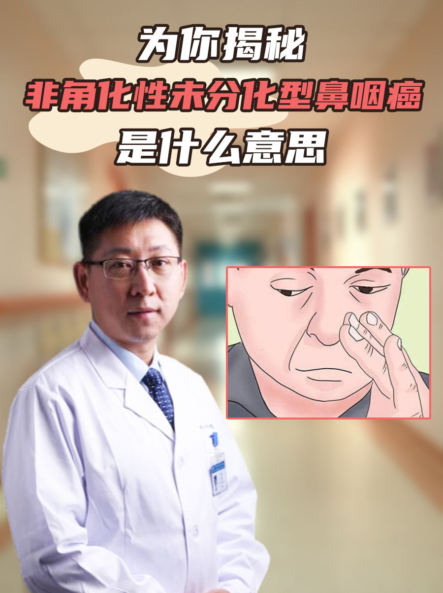 为你揭秘非角化性未分化型鼻咽癌是什么意思