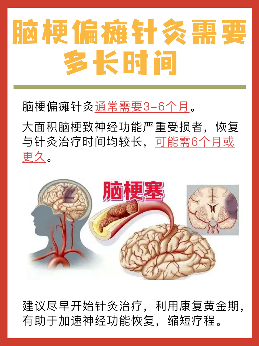 探究：脑梗偏瘫针灸需要多长时间