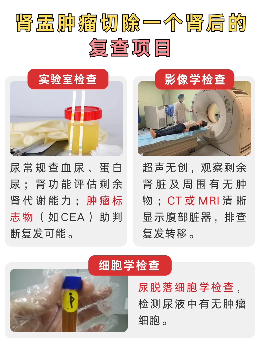 切了一个肾，肾盂肿瘤还会“卷土重来”吗？