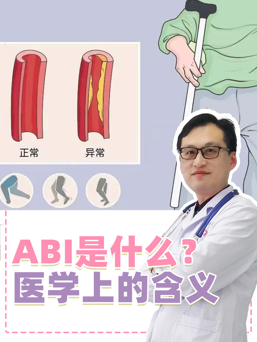 ABI是什么？医学上的含义