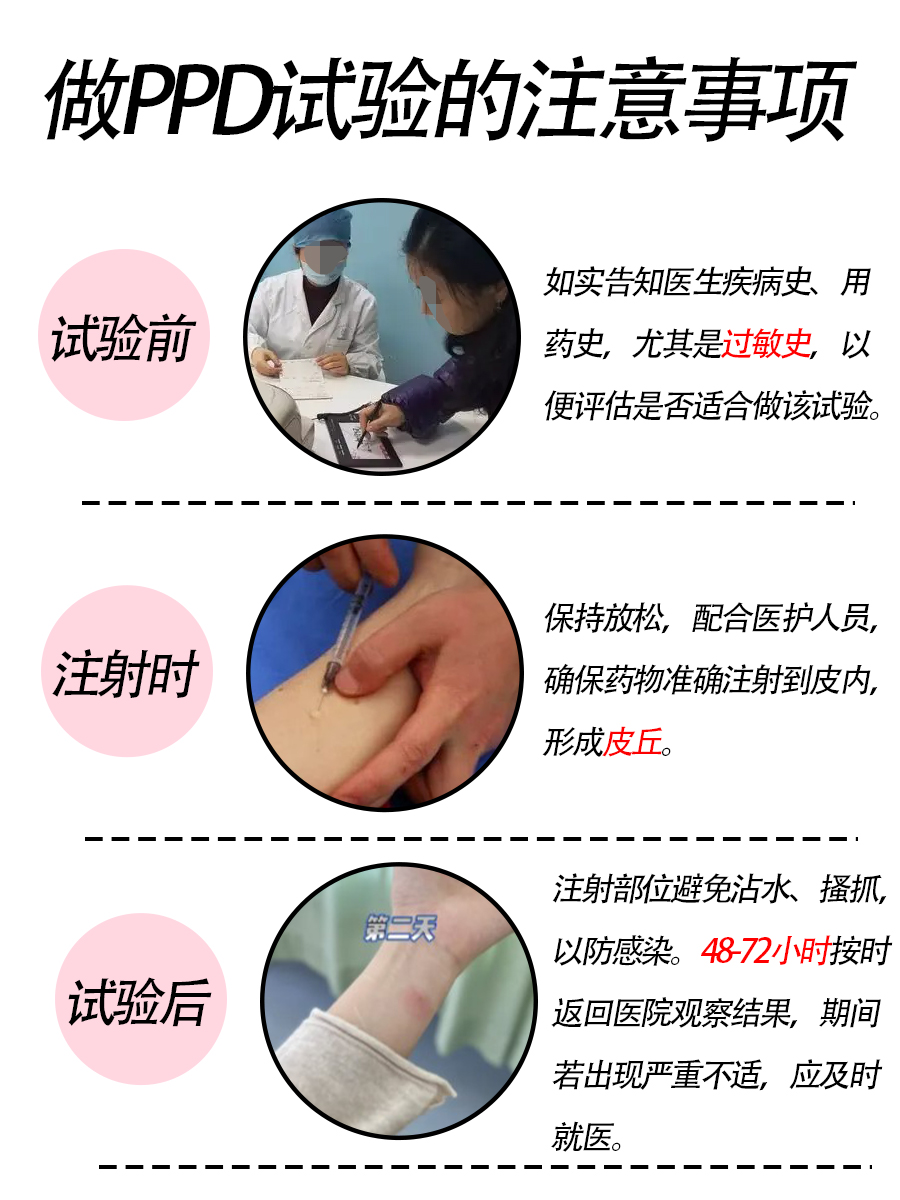 好奇！PPD试验怎样才算出现硬结