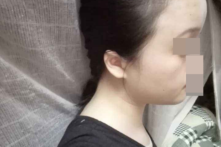 生理性额头凸侧面图