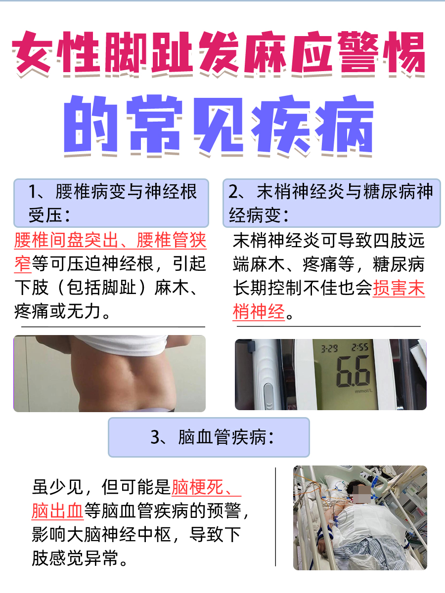 警惕！女性脚趾麻，这些病可能找上门！