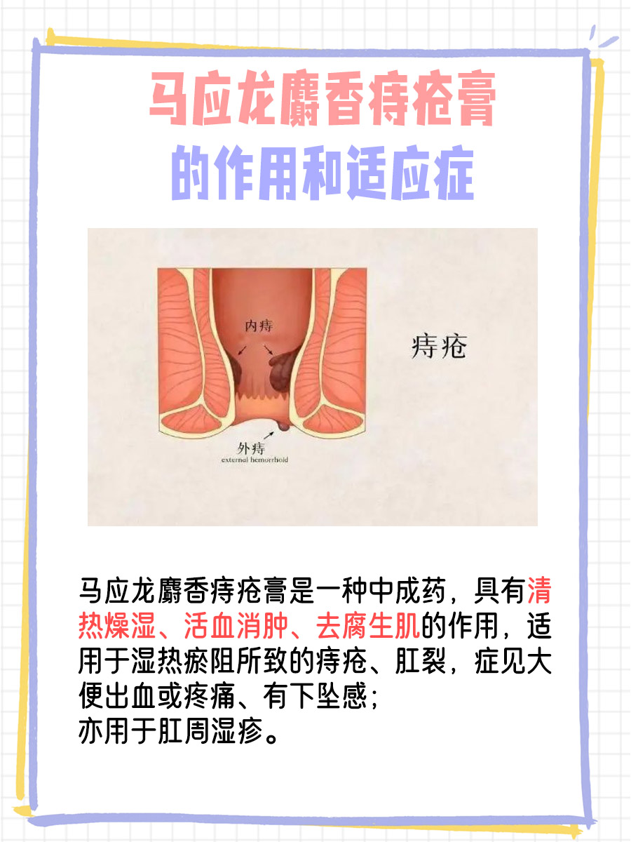 对付痔疮，马应龙和卡波姆谁更胜一筹？