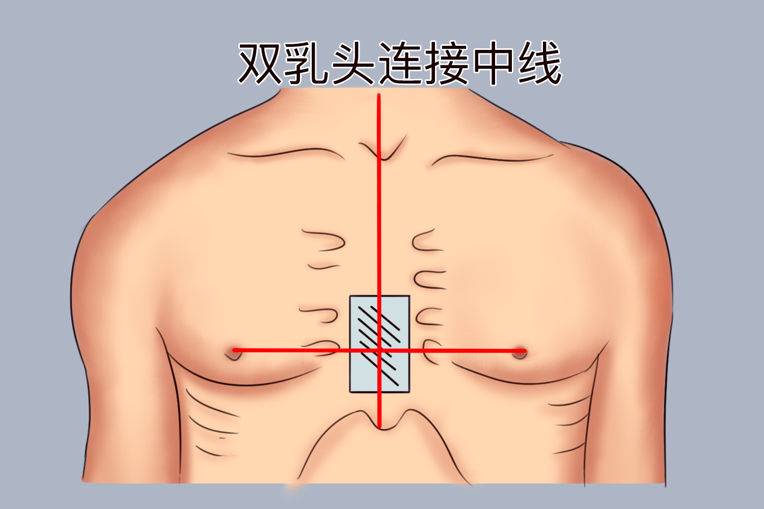 心肺复苏胸部按压部位图 心肺复苏胸部按压部位图