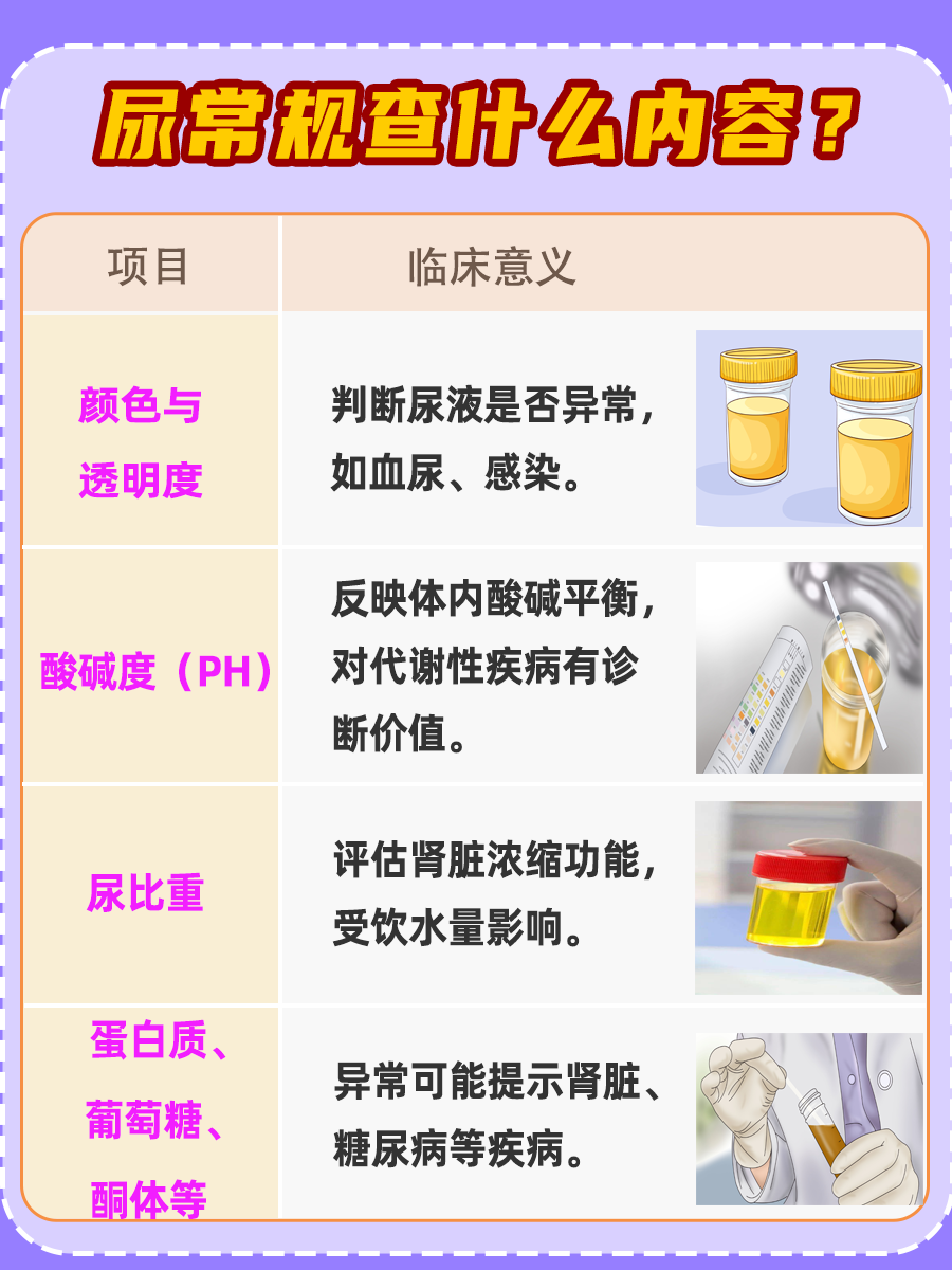 尿液里的健康密码：揭秘尿常规检查必知项
