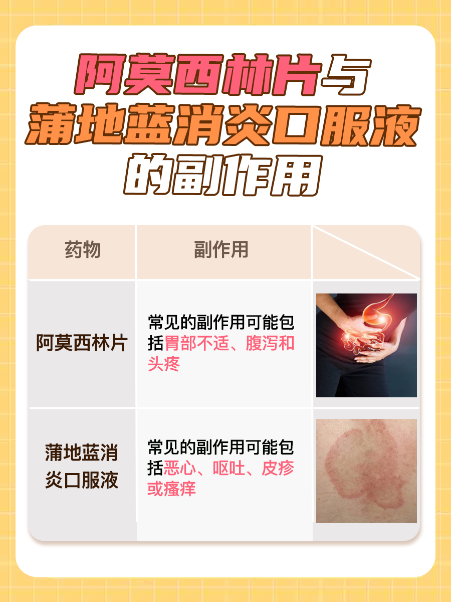 阿莫西林片与蒲地蓝消炎口服液能否同时使用？