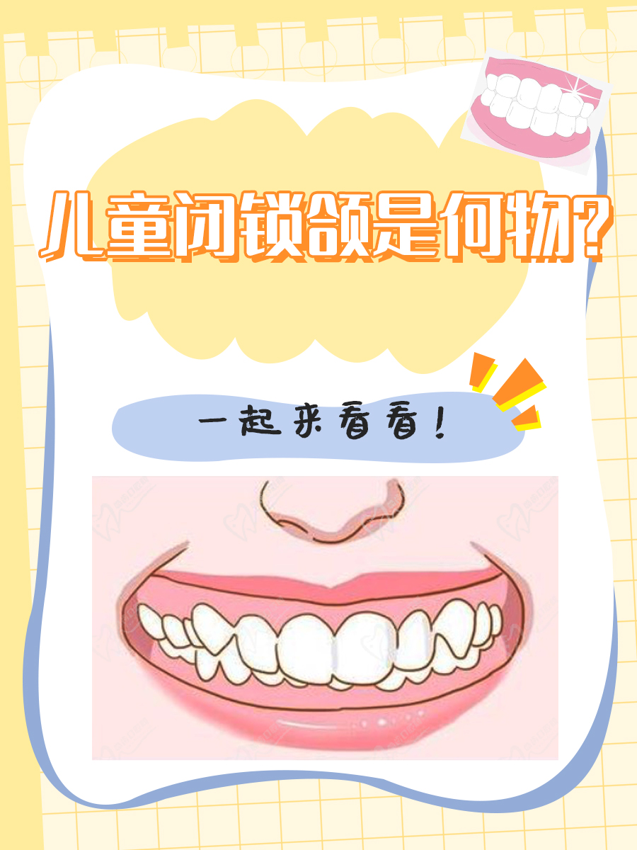 儿童闭锁颌是何物?一起来看看!