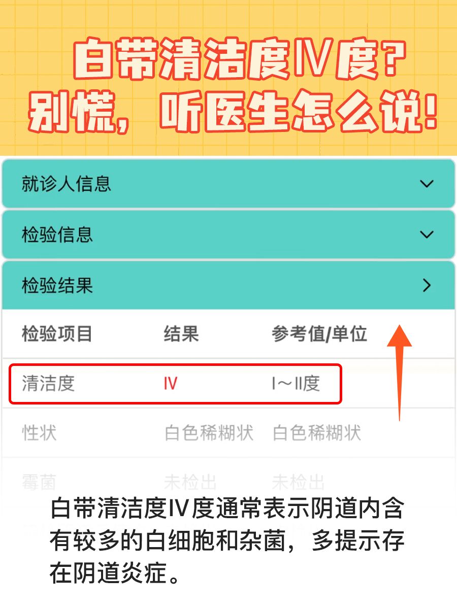 白带清洁度Ⅳ度？别慌，听医生怎么说！