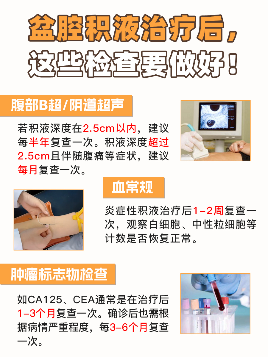 盆腔积液原因、治疗太难懂?这篇文章说清楚