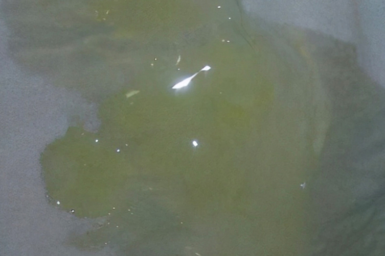 无色胶冻样痰图 无色胶冻样痰图