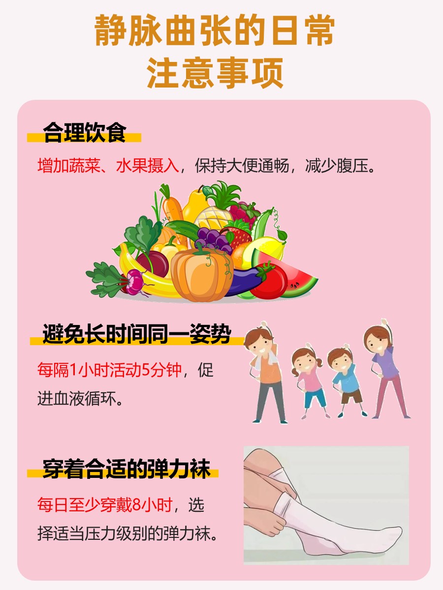 静脉曲张药物治疗推荐，这种药物更有效