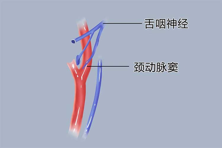 颈总动脉窦部结构图图片