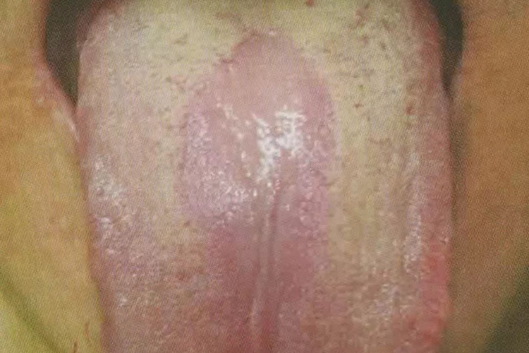 中剥苔图 中剥苔图