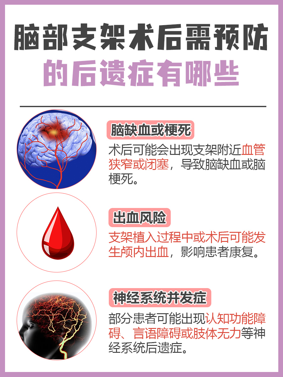 脑部支架术后全面指南：安全恢复