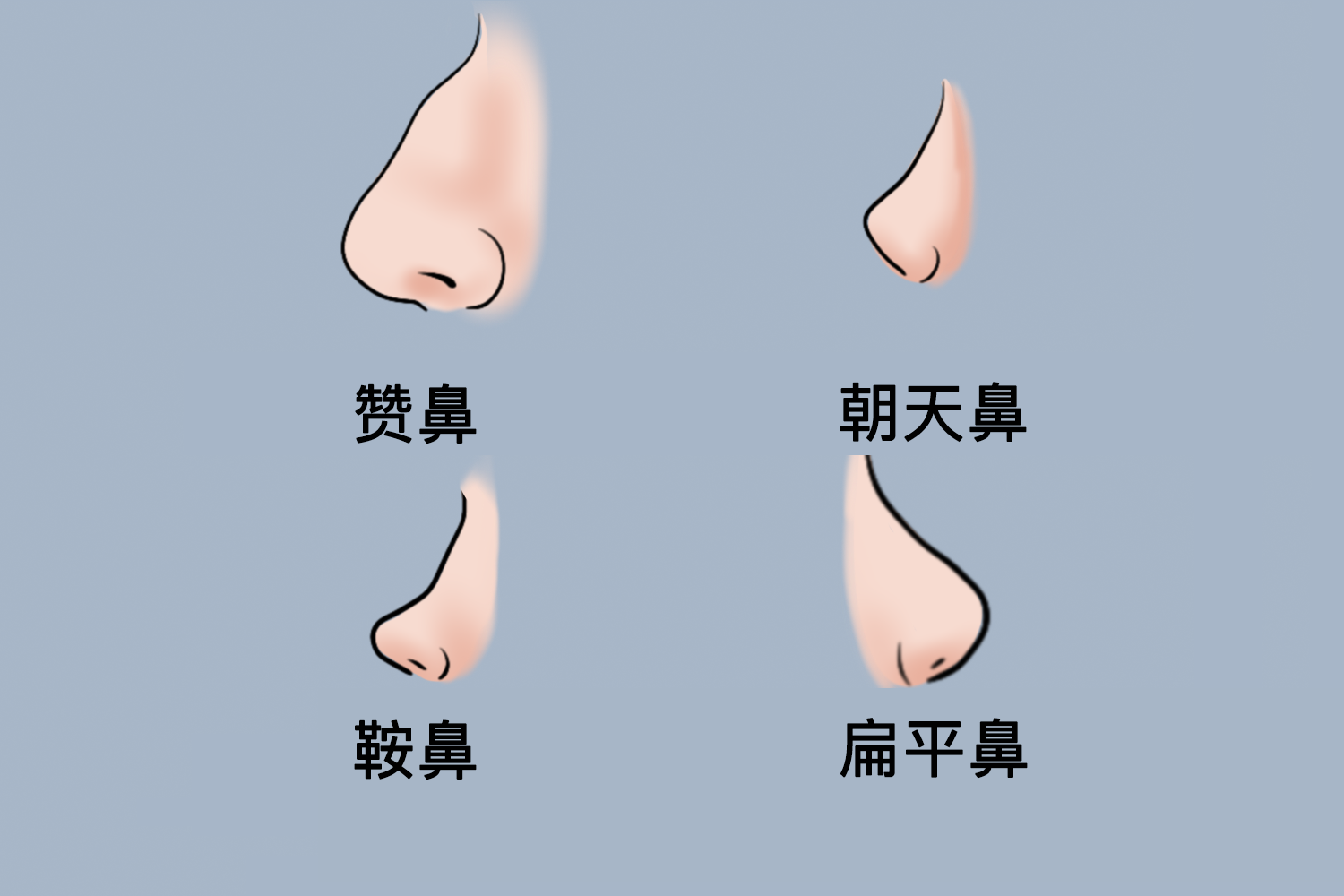 赞鼻、朝天鼻、鞍鼻、扁平鼻型图 赞鼻、朝天鼻、鞍鼻、扁平鼻型图