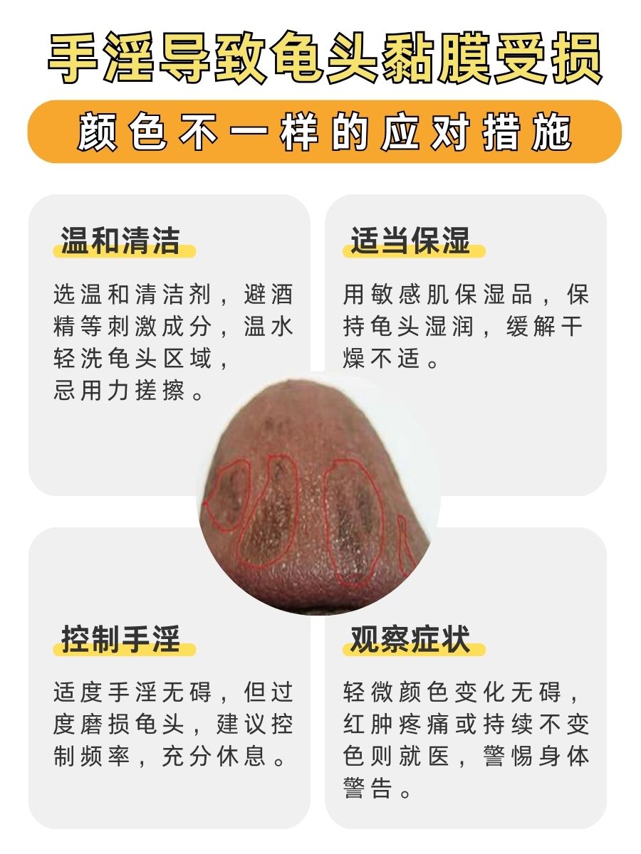 警惕！手淫龟头黏膜受损，颜色不一样该怎么办？