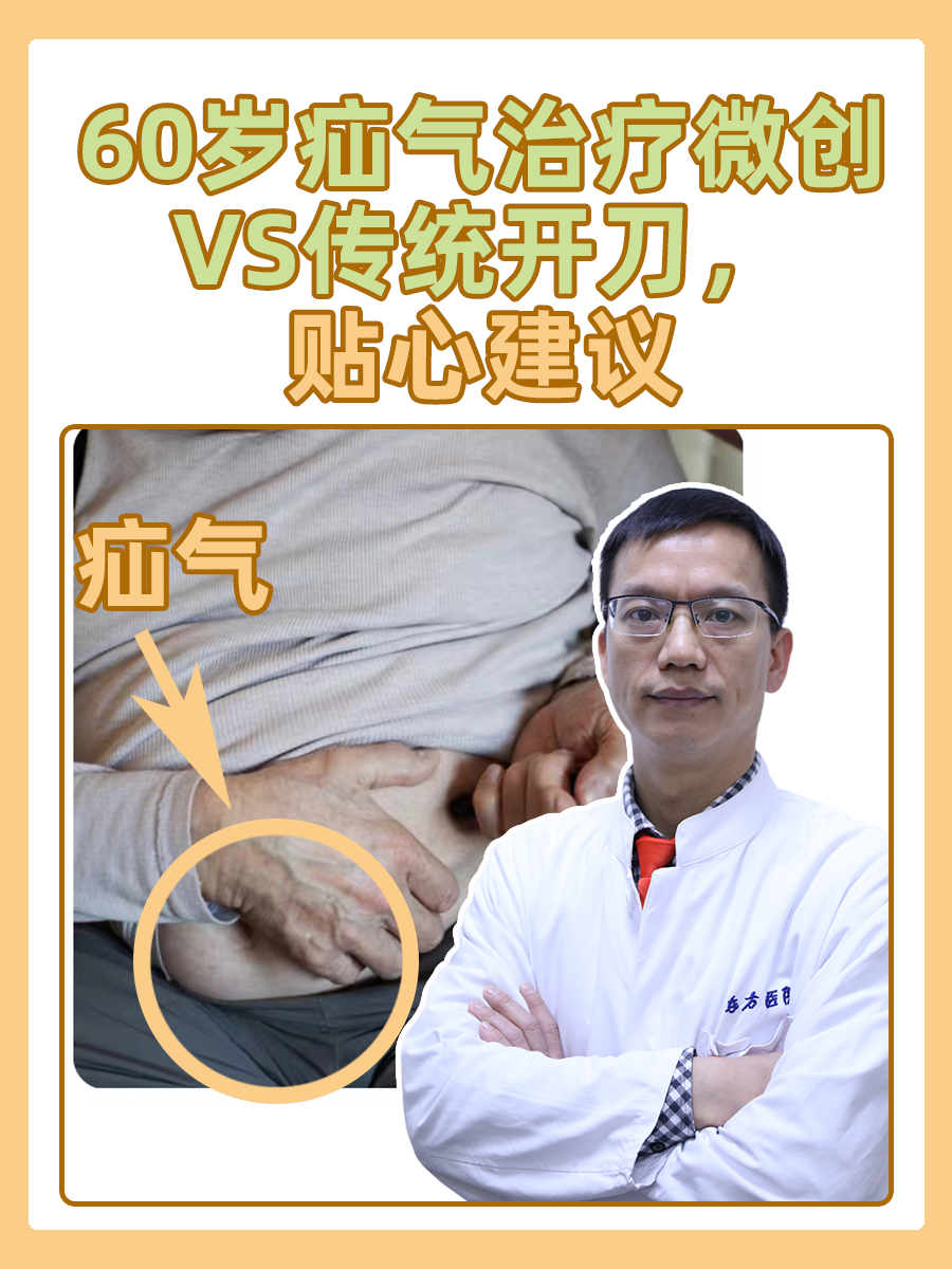 60岁疝气治疗微创VS传统开刀，贴心建议