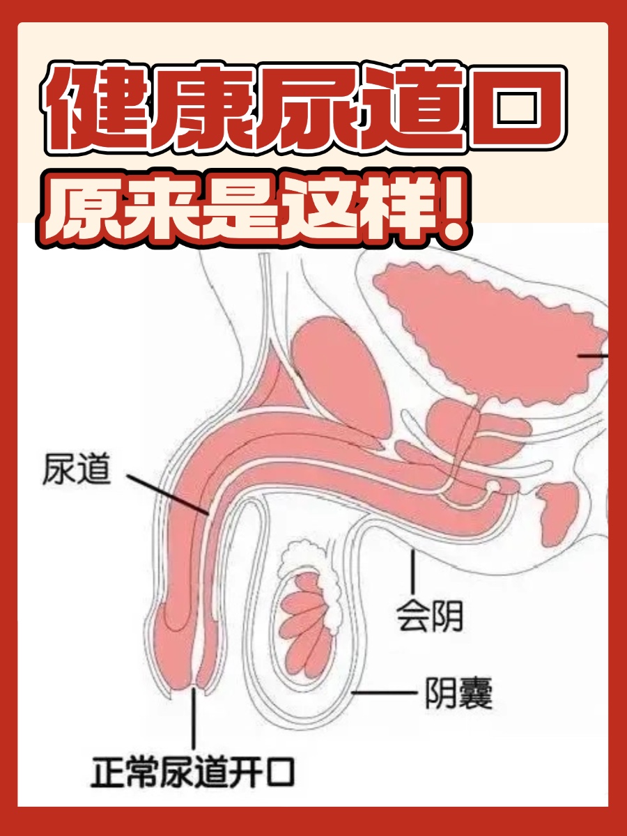 健康尿道口，原来是这样！