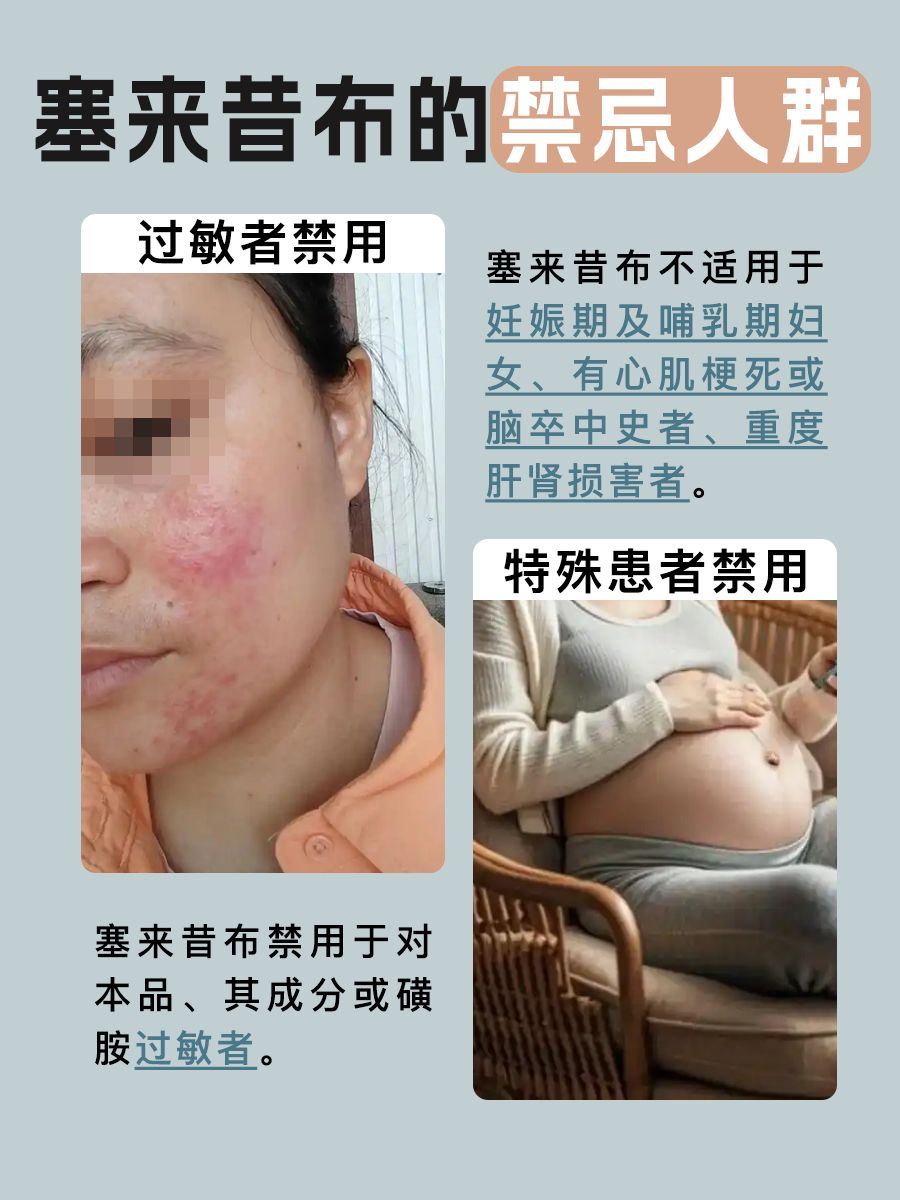 塞来昔布：一种多效非甾体抗炎药