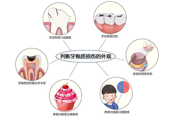 如何判断牙釉质损伤