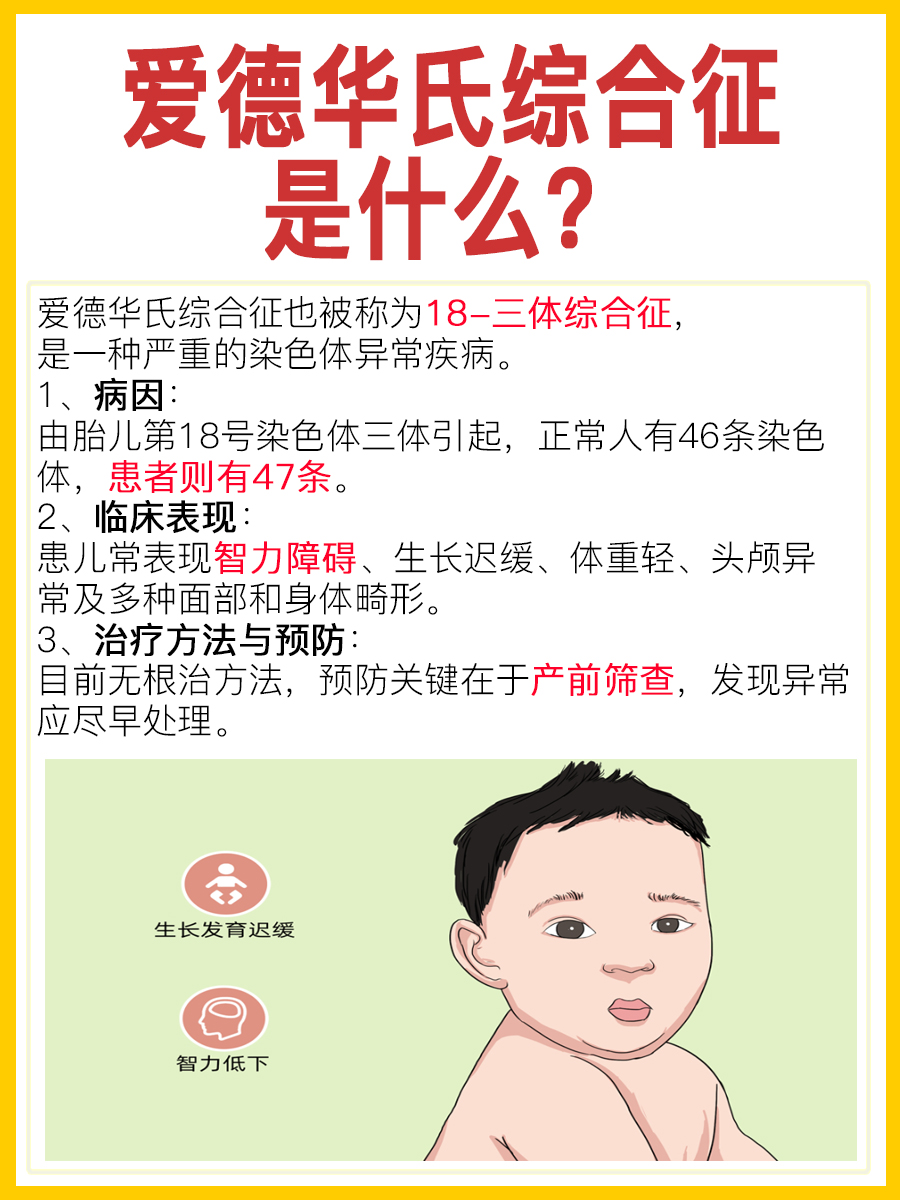 医生科普：爱德华氏综合征