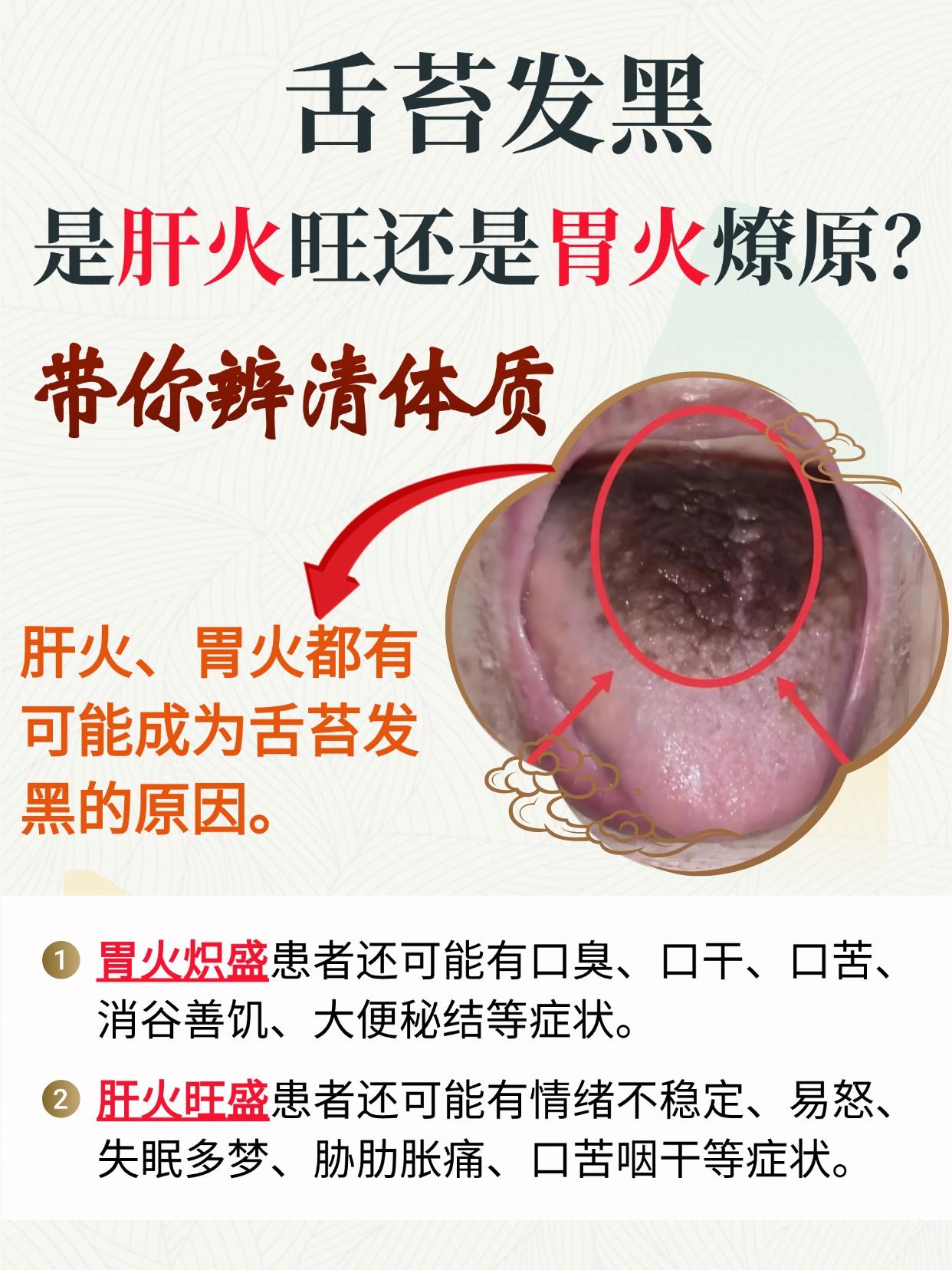 舌苔发黑，是肝火旺还是胃火燎原？带你辨清体质