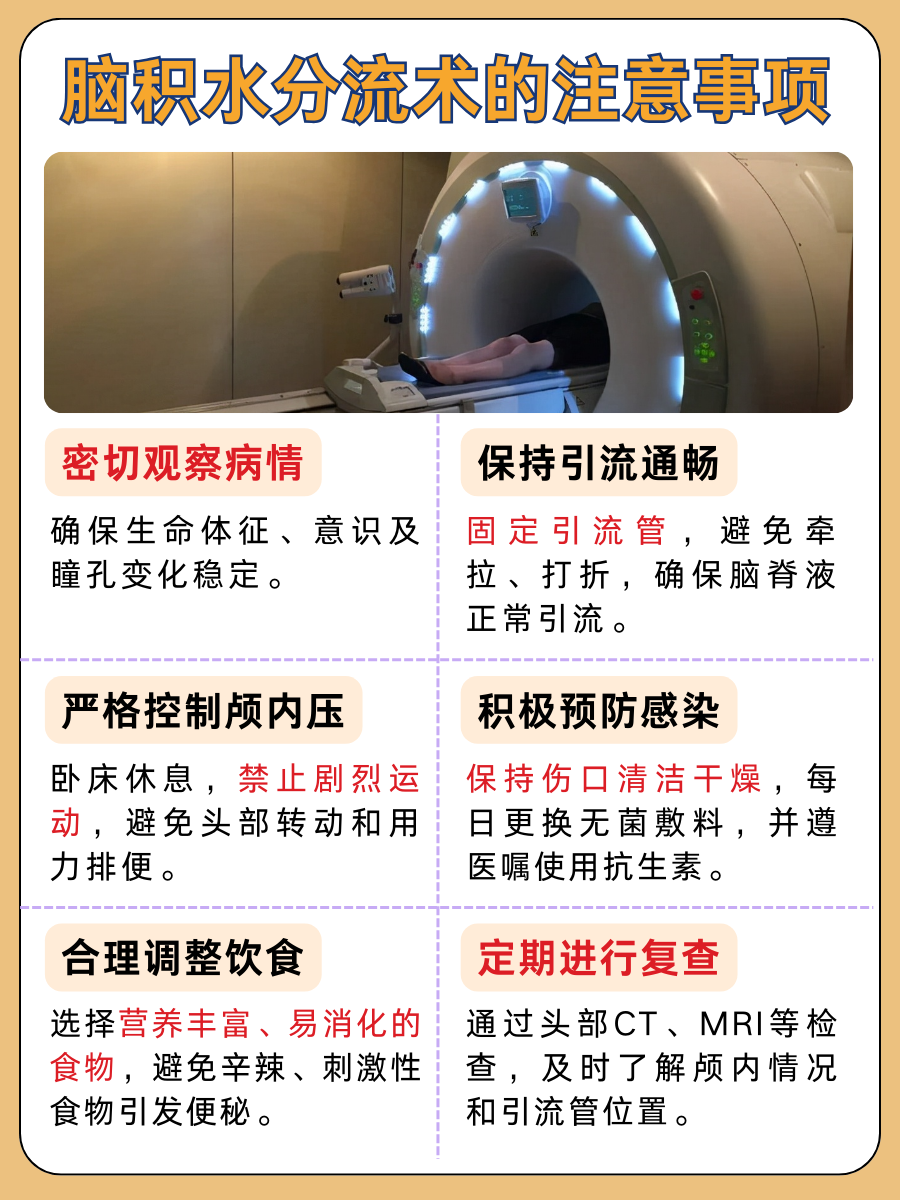 脑积水分流术,效果维持时限到底是多少?