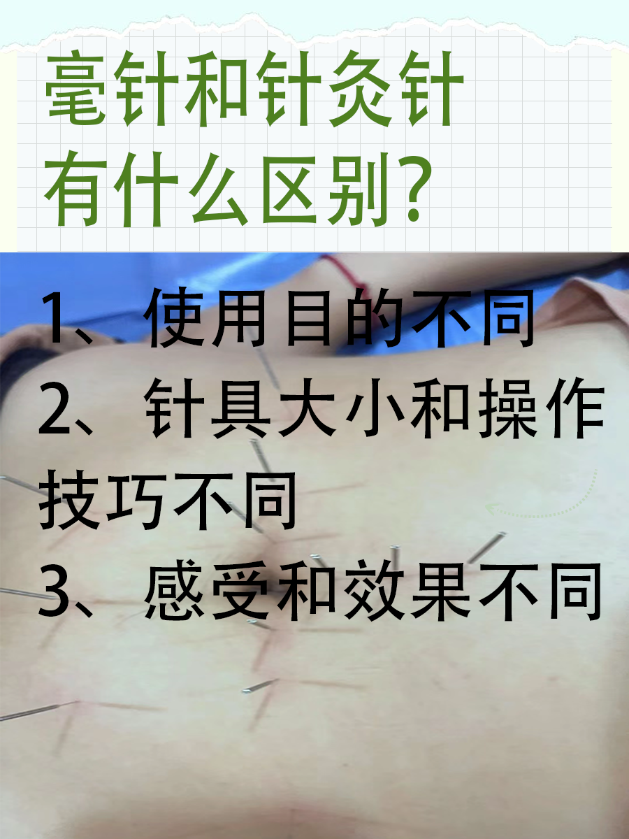 毫针和针灸针有什么区别？医生一文讲清！